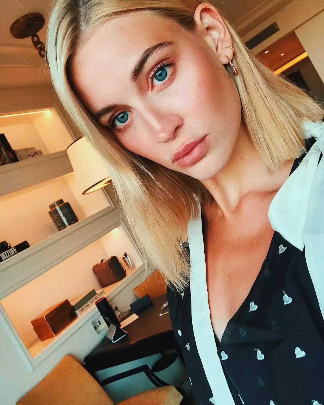 祛痘除了刷酸还有别的办法吗,祛痘有没有靠谱的方法