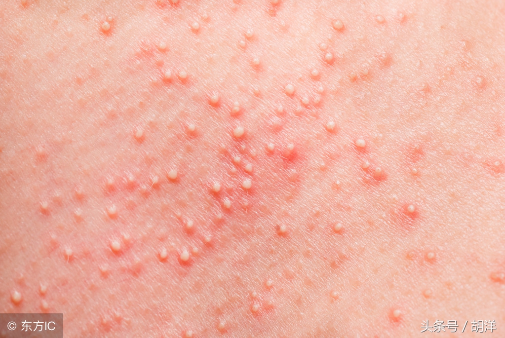 靶向药治疗肿瘤可以活多久,靶向药治疗肿瘤后期效果如何