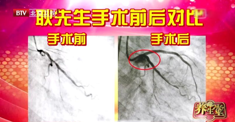 胸痛突发,感到胸痛要警惕四种病