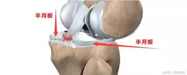 半月板受伤后就成废人了,半月板受伤了可以彻底恢复吗