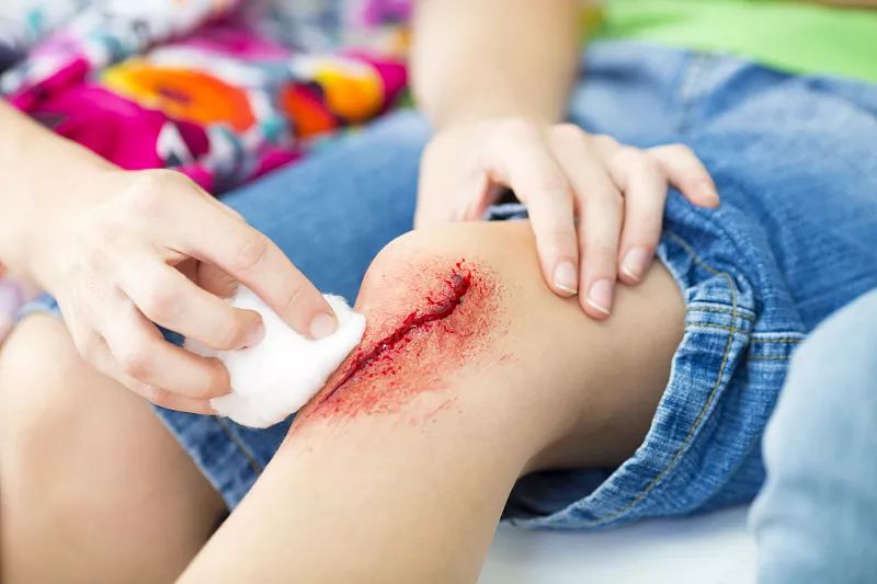 伤口消毒，酒精、碘伏、紫药水……到底怎么用？