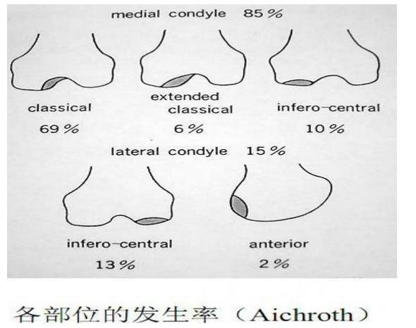 常见的十大膝关节疼痛,老年患者膝关节疾病健康科普