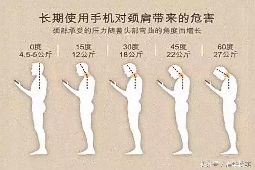 吓尿！每天玩手机4小时，8年后开刀换骨！颈椎病，正疯狂袭来！