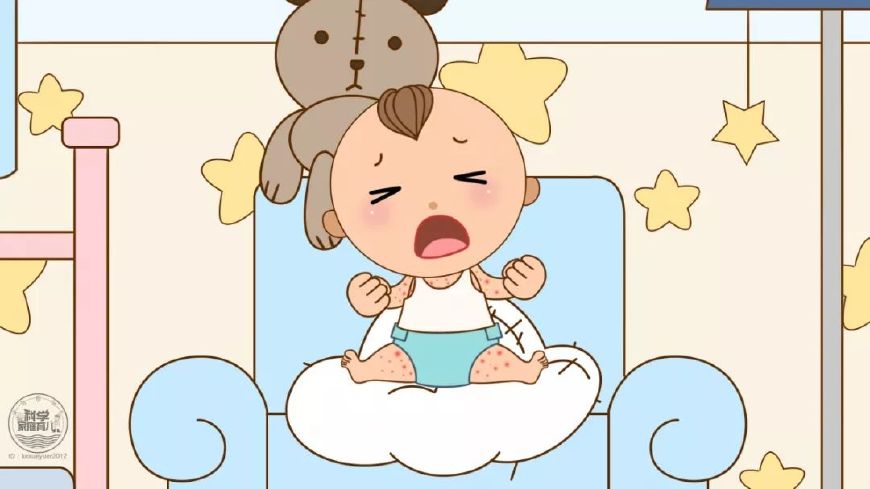 怎么判断是荨麻疹还是幼儿急疹,宝宝得了荨麻疹需要忌口吗