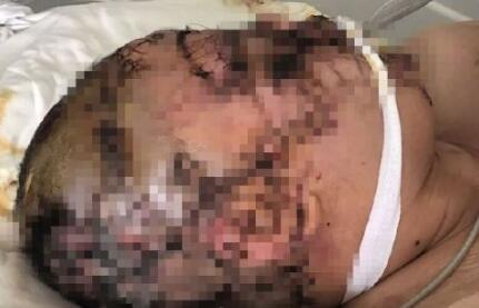 粉色花海被踩踏,花海遭践踏