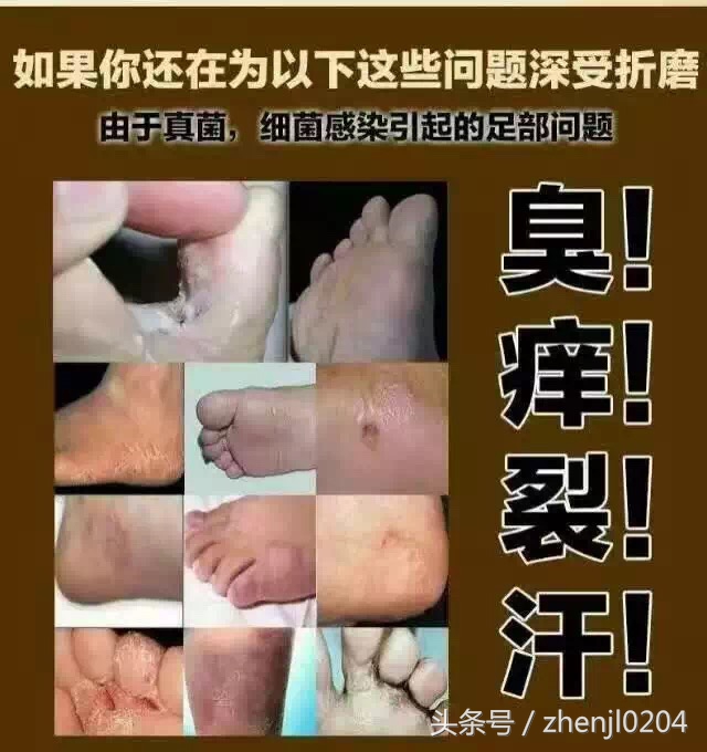 晚间脚气知识科普,科普脚气小知识
