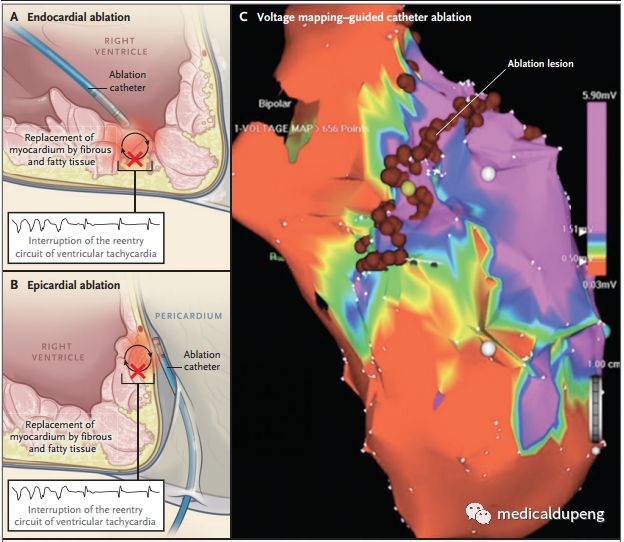 医学插画插图,医学插画sci