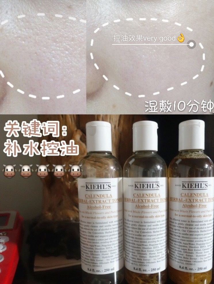 混油皮护肤水清爽型,混油皮护肤水保湿补水抗衰老推荐