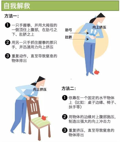 孩子异物卡喉急救后窒息了怎么办,婴儿异物卡喉急救方法和注意事项