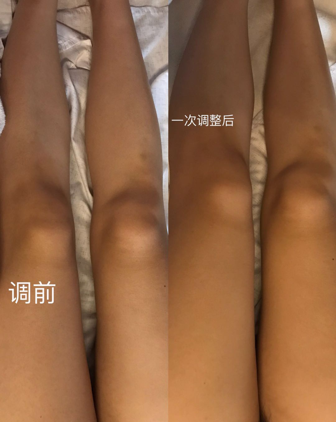 美容院做产后修复操作手法,美容院产后恢复有什么项目