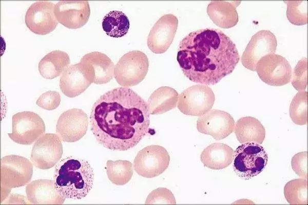 关于EGC身为铲屎官的你知多少？各种皮肤病都可能是EGC！