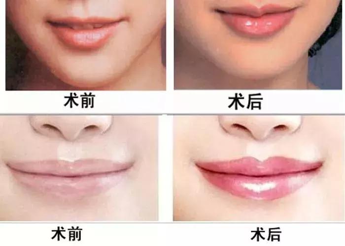 眉毛做半永久的操作流程,想做半永久眉毛怎么选择