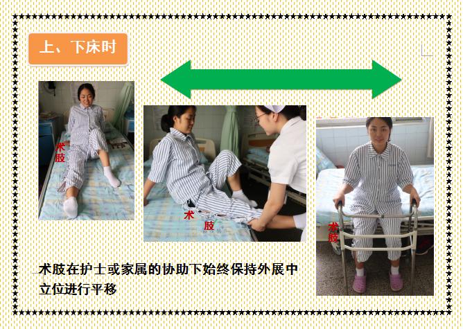 人工髋关节置换术前准备护理,人工髋关节置换术的健康宣教手册