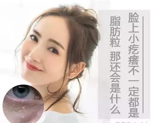 儿童脸上长一粒粒小疙瘩像脂肪粒,宝宝脸上起的类似脂肪粒的疙瘩