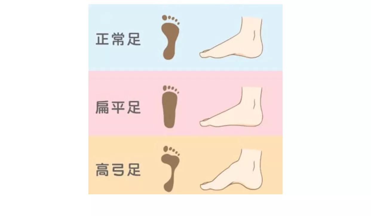 看准脚型再买鞋，才能买的舒心呐！