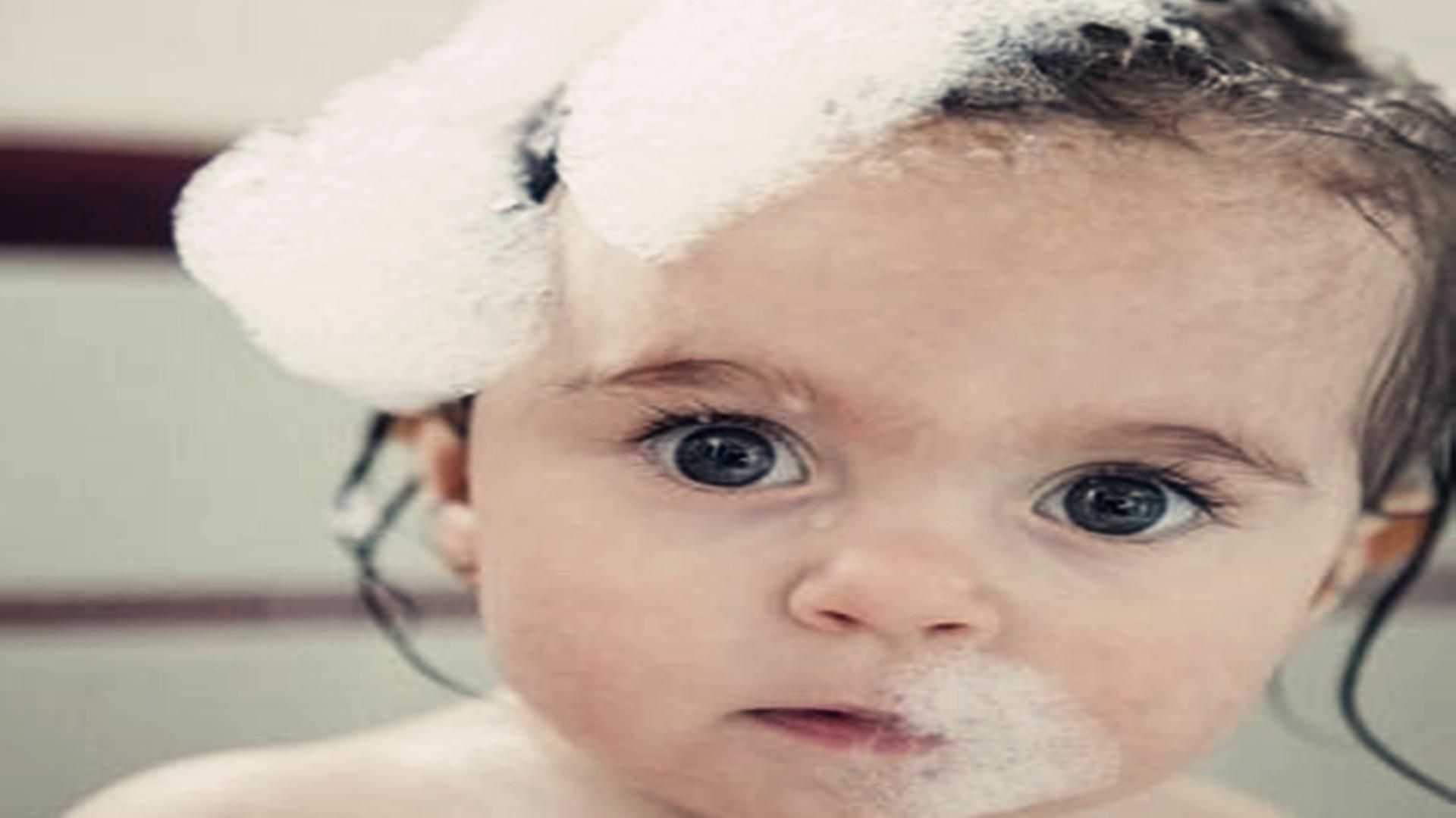 孩子头皮有头屑用什么洗能掉,宝宝头皮头皮屑多怎么回事