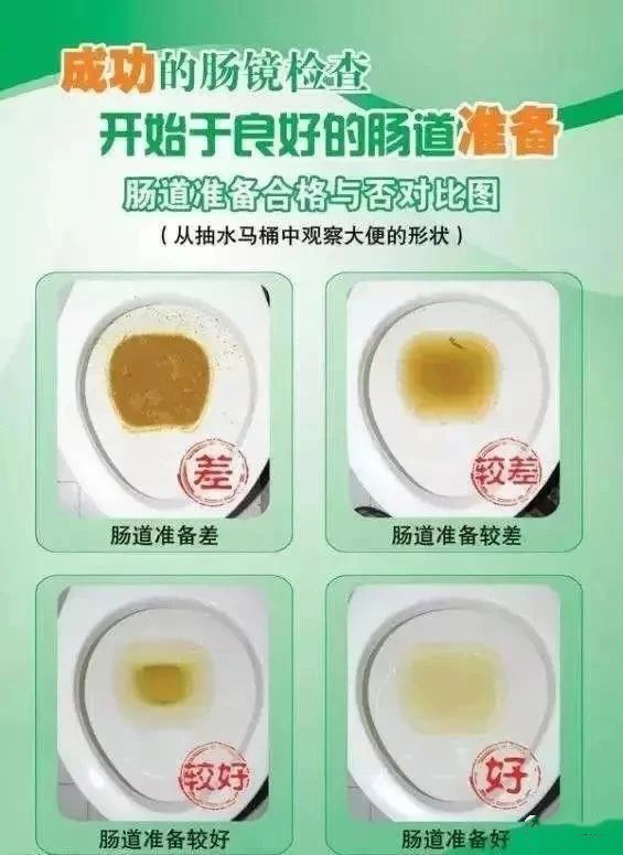 胃镜检查胶囊内镜好吗,胃镜胶囊胃镜钡餐有什么区别