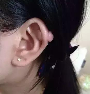 番禺区打耳洞,广州番禺哪家医院可以打耳洞