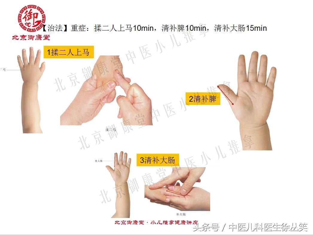 小儿腹泻中医按摩的方法,小儿秋季腹泻推拿常用手法