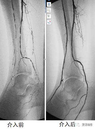 脚发麻发凉发痛应该挂哪个科,脚痛膝盖疼旁边筋痛