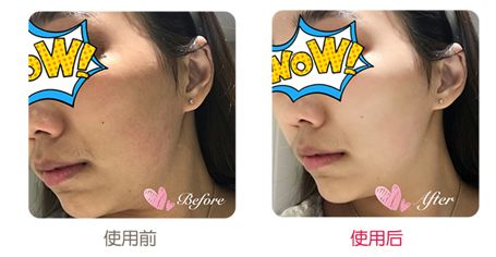 有了这瓶“液体黄金“,今年秋冬注定与干燥、长痘无缘了!