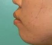 她红了半辈子，结果却因为这个脸部缺陷被骂到退圈？！