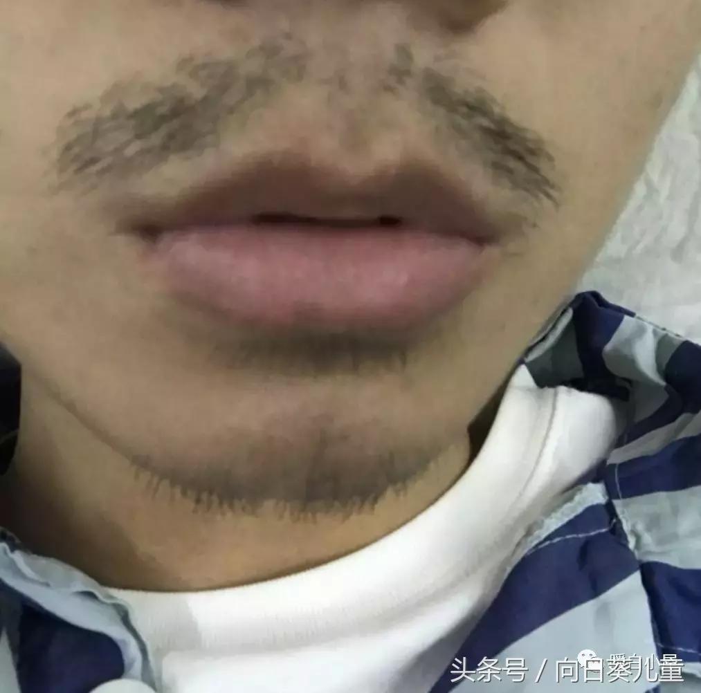 我是怎么患上白血病的自述,我得了白血病怎么办