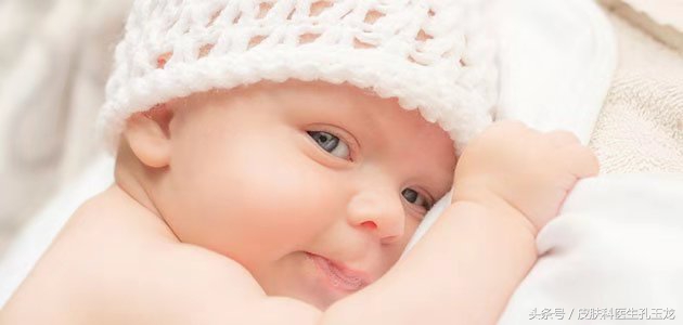 婴儿湿疹导致皮肤干燥怎么治疗,宝宝湿疹皮炎是什么原因引起的