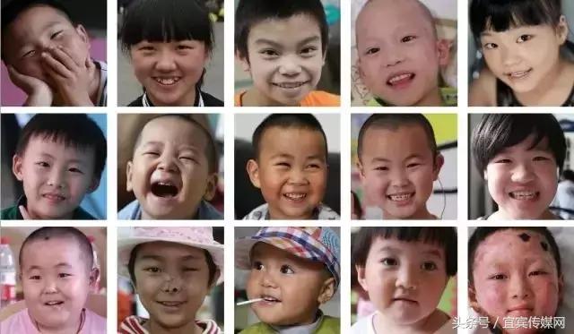 9958儿童紧急救助直播,四川儿童大病救助