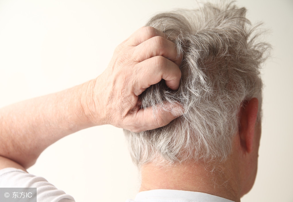 头皮屑每天太多怎么办,头皮屑太多了洗头发加什么洗