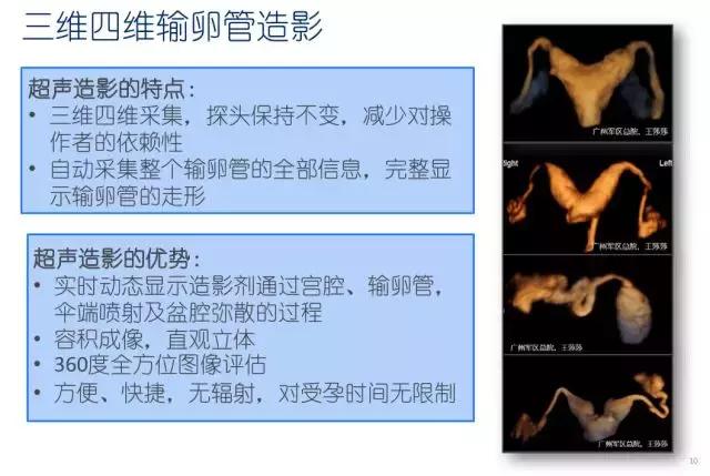 妇科超声波探头,福建省妇幼保健院输卵管超声造影