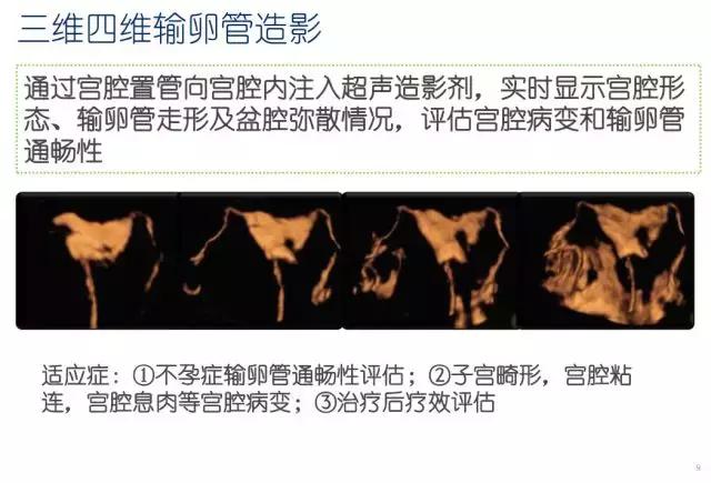 妇科超声波探头,福建省妇幼保健院输卵管超声造影