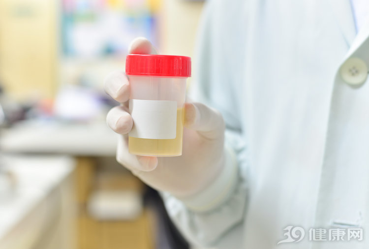 肾病小便泡沫多怎么回事,小便泡沫多是尿毒症么