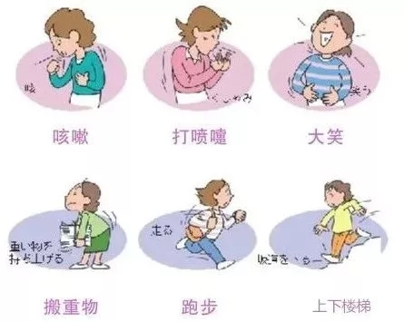 怎么避免大笑时笑尿,如何解决笑尿的尴尬