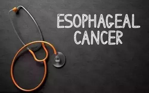 人最容易得的几大癌症,最易得的十种癌症