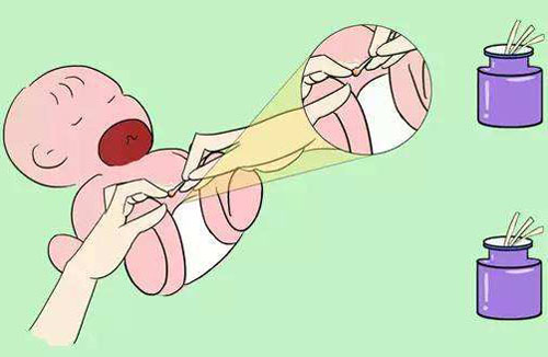 宝宝肚脐突出有脐疝需要注意啥,宝宝肚脐突出脐疝会造成哪些影响