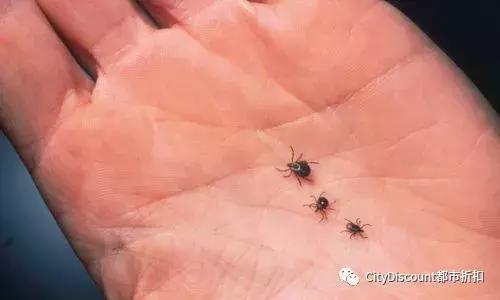 女子发现蜱虫被咬后续,一女子被十几只蜱虫咬