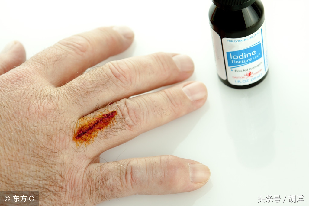 摔伤破皮擦碘伏发白,小孩子脸上擦伤可以用碘酒消毒吗