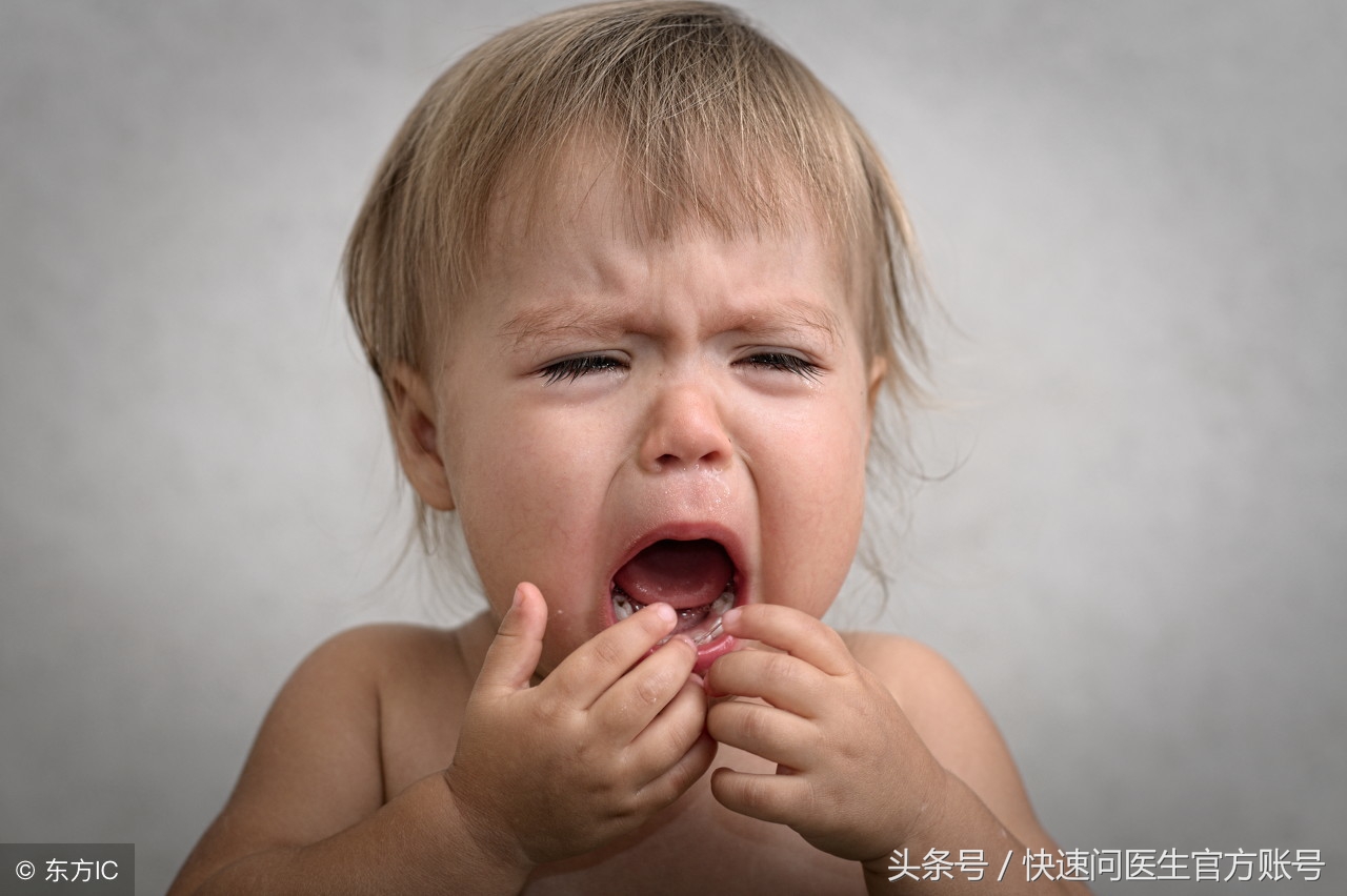 避免宝宝“兔唇”，孕期准妈妈这五件事情可一定要注意！