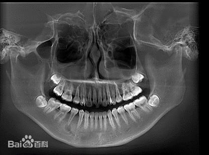 美亚光电深度分析2019,美亚光电深度分析最新