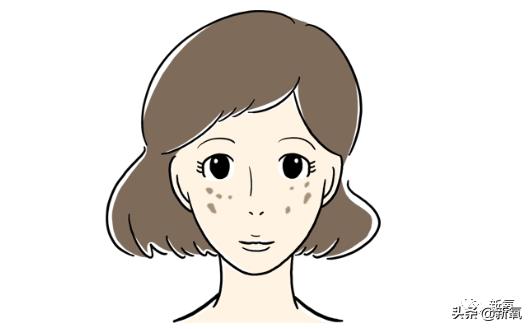 宋祖儿雀斑造型美到窒息,宋祖儿脸上的雀斑一清二楚