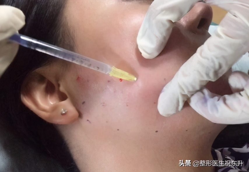 不明注射物有什么后遗症,远离不明注射物