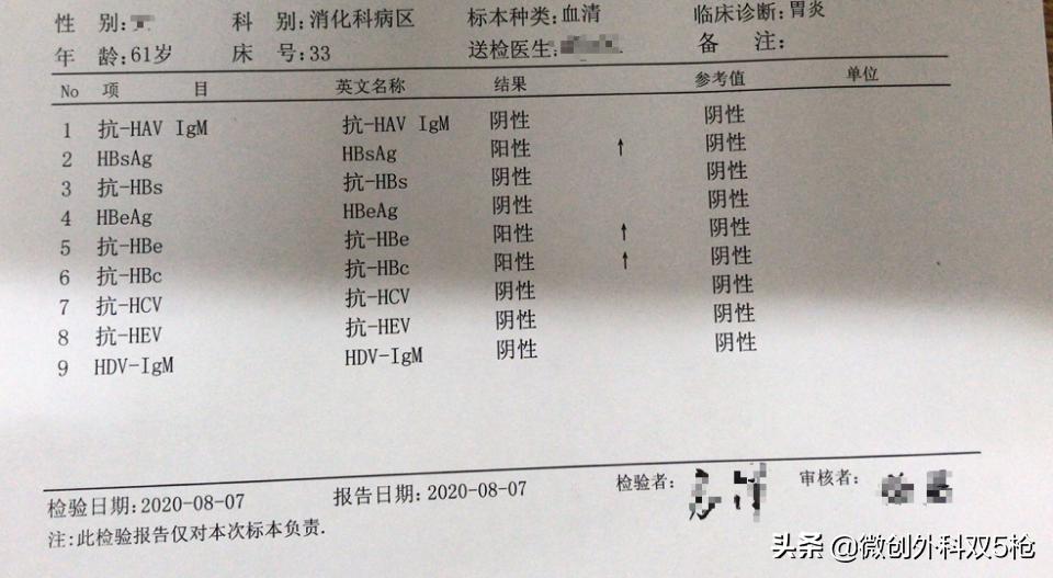 有乙肝大三阳经常喝酒会怎么样,乙肝大三阳经常喝酒会怎么样