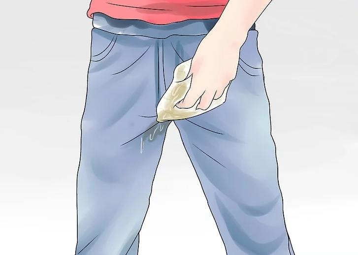 容易尿湿裤子怎么避免,尿湿裤子小妙招