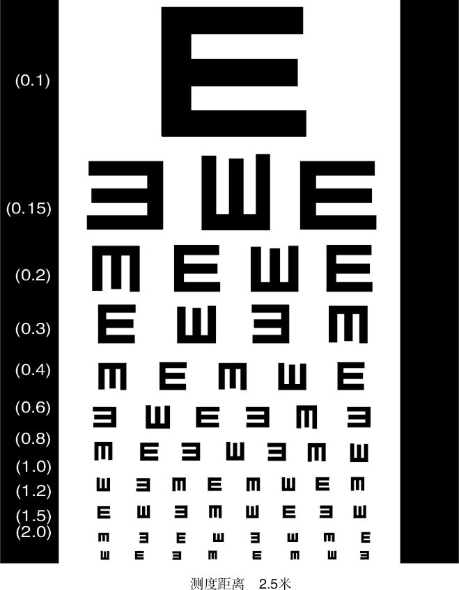 4岁孩子视力5.0但是散光125度,三岁孩子体检视力有点弱有点散光