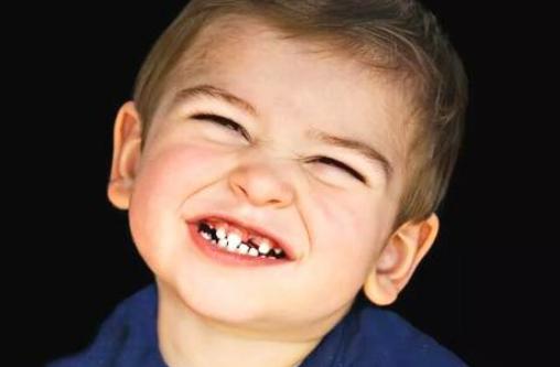 一周宝宝牙齿有黑渍能刷牙吗,宝宝牙齿发黑怎么办用什么牙膏