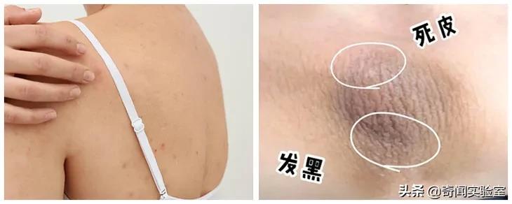 自己搓澡搓不到后背怎么办,洗澡怎样才能搓干净后背