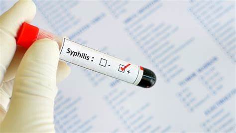 梅毒螺旋体检测阳性会传染吗,梅毒检查是阴性会传染给别人吗