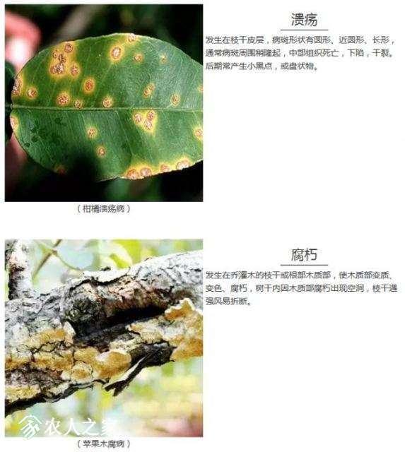 每日一课100个常识,真菌感染必备知识