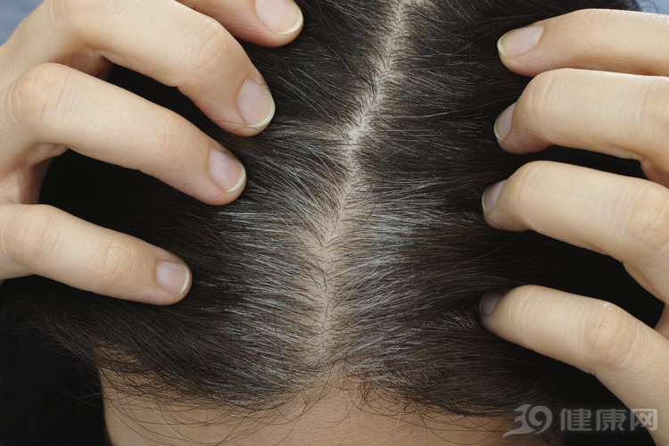 白发别担心教你轻松遮盖白发,要用怎样的方法才能使白发变黑发